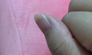 指甲上有一条条竖线 大拇指上有一条黑色的竖线